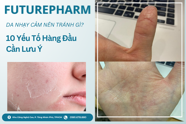 Da nhạy cảm nên tránh gì – 10 yếu tố hàng đầu cần lưu ý để bảo vệ da khỏe mạnh